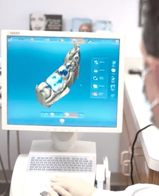 Dental crowns at A Shop for Smiles in La Mesa